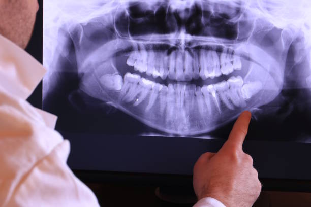 Best Emergency Gum Pain Relief  in Reserve, LA