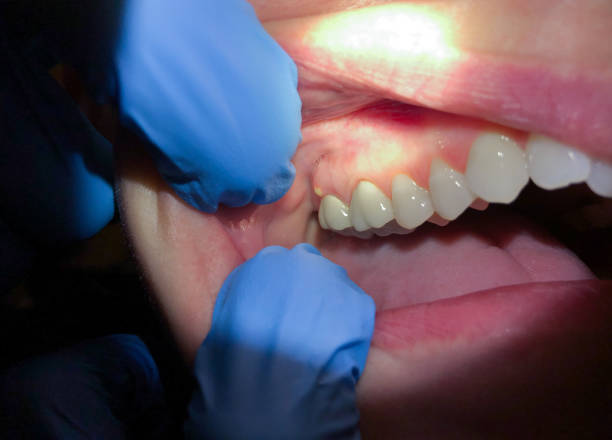 Emergency Dentist Open Today in LA